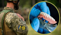 Стало відомо, в яких лікарнях Рівненщини військовики зможуть безплатно протезувати зуби